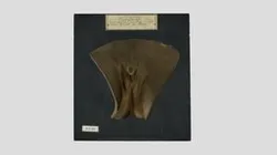 Hermaphrodisme