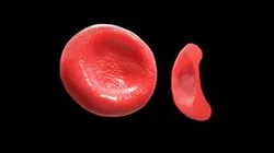 Red blood Cell