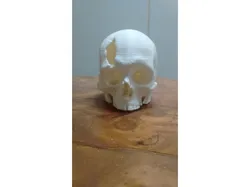 Cráneo con fractura en hueso frontal, tomografía computada.