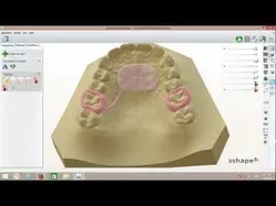 Digital Nance Holder Appliance 3D print model