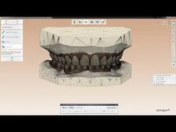 Digital Orthodontic Study Models with Virtual ABO Bases 3D print model