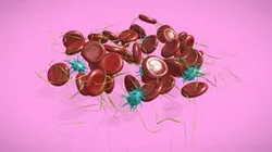 Blood Clot