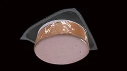 Package of Bologna