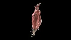 Shoulder - Instability: Sulcus Sign - Female