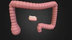 Colon