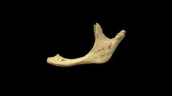 Edentulous Mandible with DJD (VCU_3D_4019)
