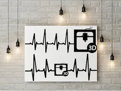 Heart Beat 3D printer  2D