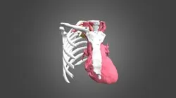 Tumor