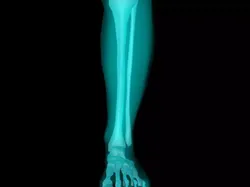 X Ray Ankle Joint Medically Accurate Model 3D model