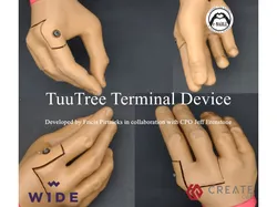 TuuTree Terminal device - Prosthetic