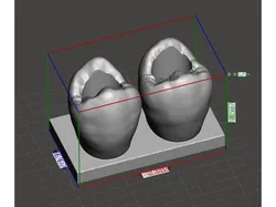 Pencil Holder (teeth)