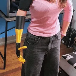Mid-height arm prosthesis