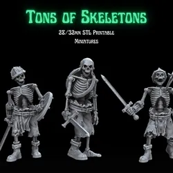 Tons of Skeletons: Equipped Skeletons