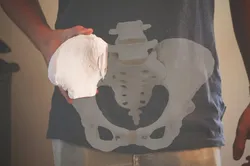 Hip Bone Segment (MRI)