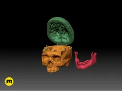 Human Skull