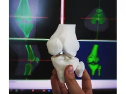 Knee (from CT scan)