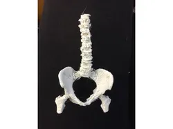 Spine and Pelvis from CT Scan