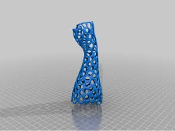 arm cast