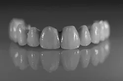 teeth