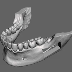 dental biomodel